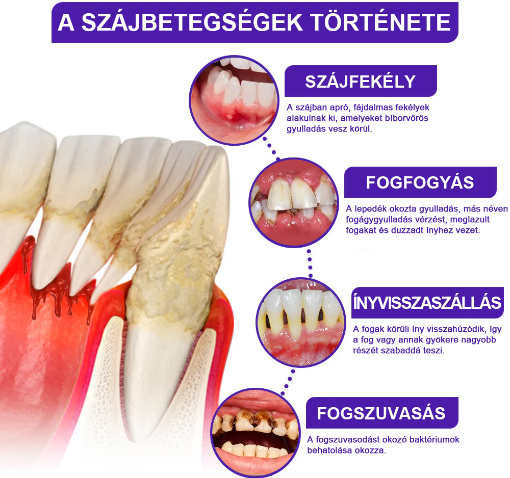 🌟Ščiti dlesni in krepi sklenino, zobna pasta za vsakodnevno ustno nego