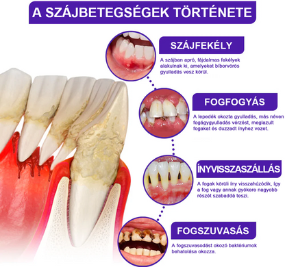 🌟Ščiti dlesni in krepi sklenino, zobna pasta za vsakodnevno ustno nego