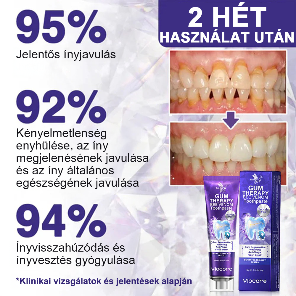 🌟Ščiti dlesni in krepi sklenino, zobna pasta za vsakodnevno ustno nego